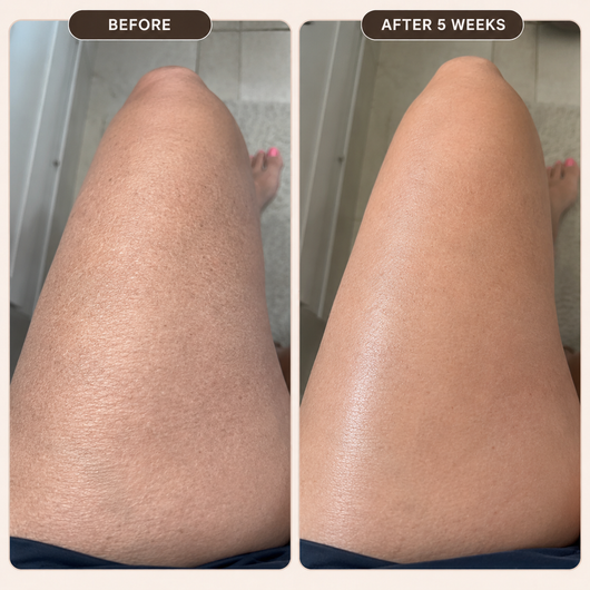 Aleo Anti Cellulite Massage Oil