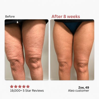 Anti Cellulite Massage Oil