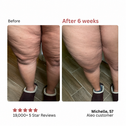 Anti Cellulite Massage Oil